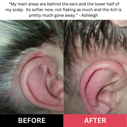 Healthy Roots Start Here – Scalp Scrub for Fresh, Fuller-Looking Hair