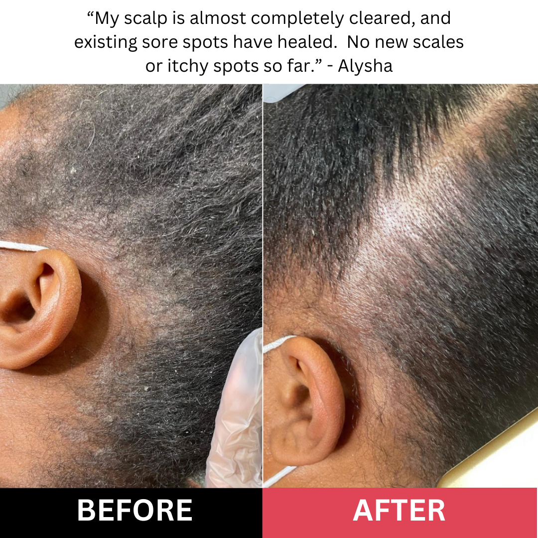 Healthy Roots Start Here – Scalp Scrub for Fresh, Fuller-Looking Hair