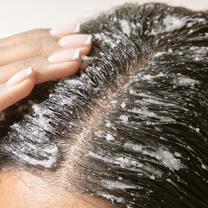 Healthy Roots Start Here – Scalp Scrub for Fresh, Fuller-Looking Hair